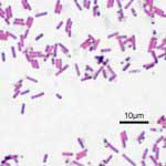 Bacillus